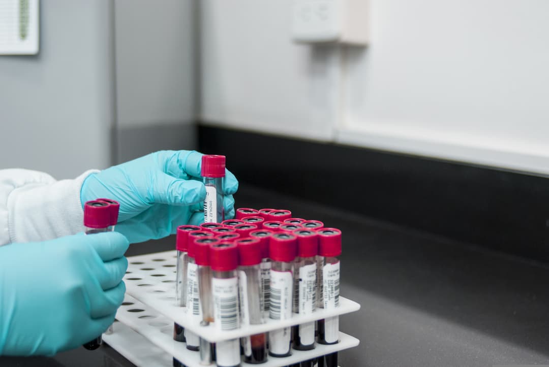 Test de detección de drogas y alcohol
